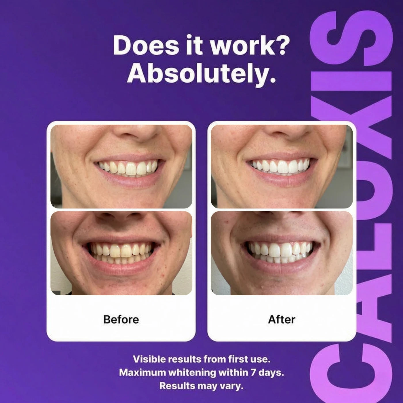 Caluxis™ Purple Teeth Whitening Strips